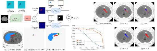 SMILE grahical abstract
